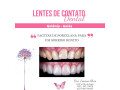 facetas-porcelana-goiania-goias-small-4