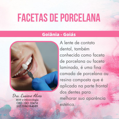 facetas-porcelana-goiania-goias-big-0